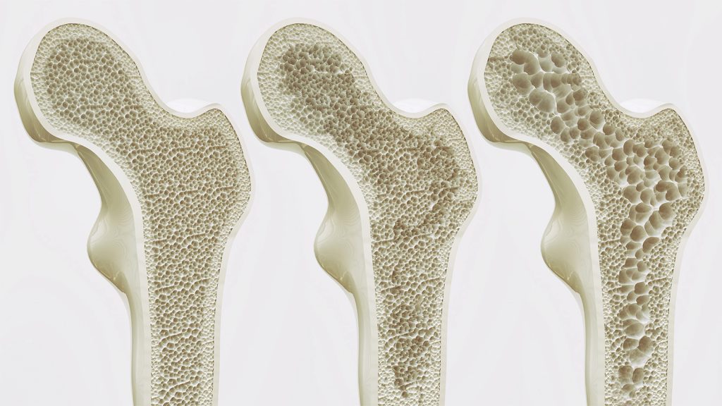 stages of bone health